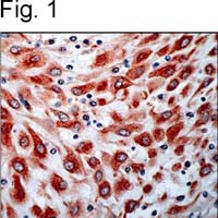 VEGF Receptor 3 Antibody in Immunohistochemistry (IHC)