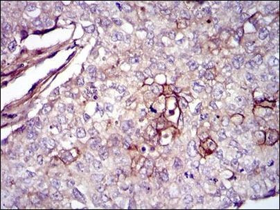 Fibronectin Antibody in Immunohistochemistry (Paraffin) (IHC (P))