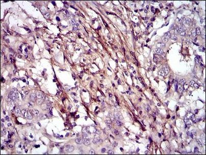 Fibronectin Antibody in Immunohistochemistry (Paraffin) (IHC (P))