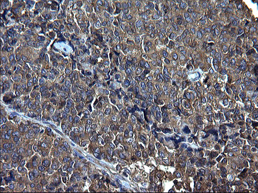 FNDC8 Antibody in Immunohistochemistry (Paraffin) (IHC (P))