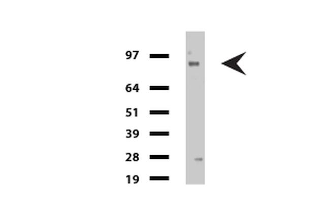 FOLH1 Antibody in Western Blot (WB)