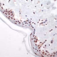 c-Fos Antibody in Immunohistochemistry (IHC)