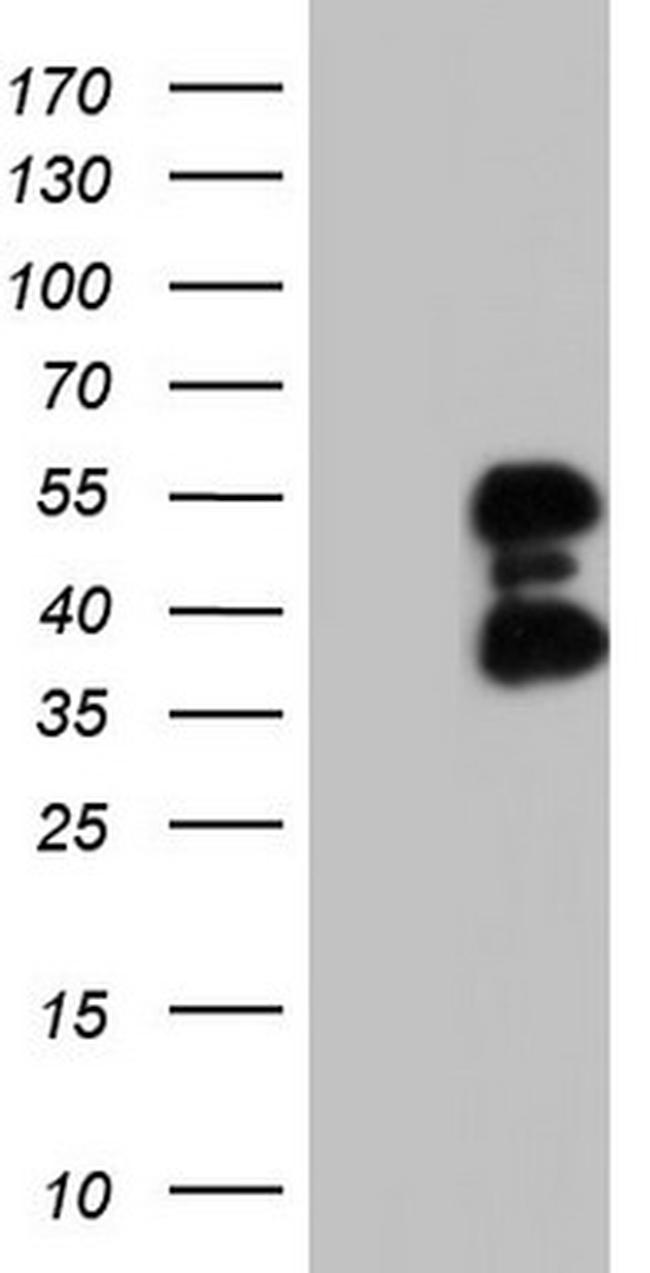 FOSB Antibody in Western Blot (WB)