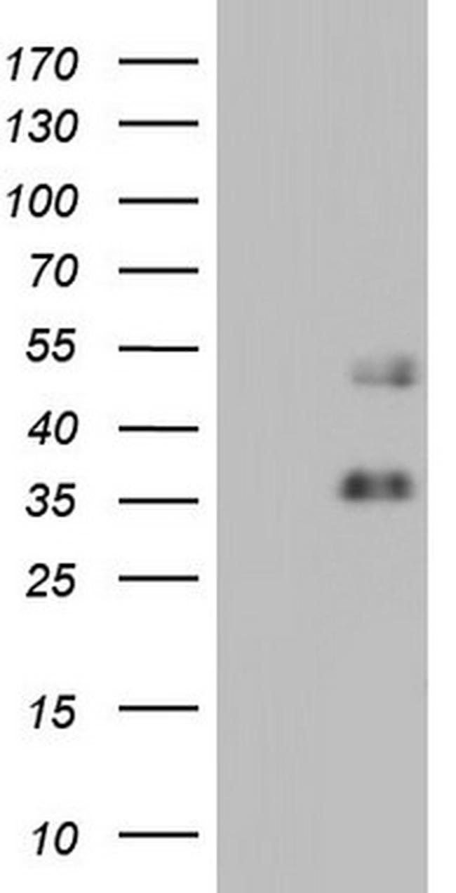 FOSB Antibody in Western Blot (WB)