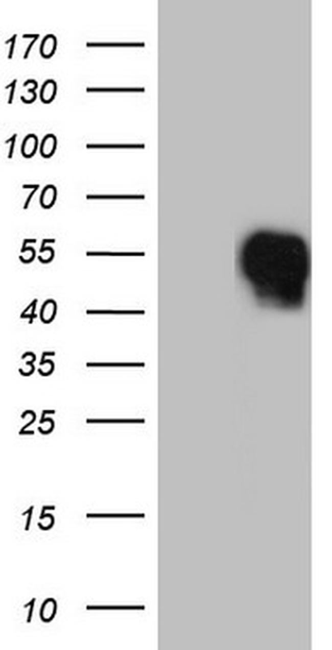 FOSB Antibody in Western Blot (WB)