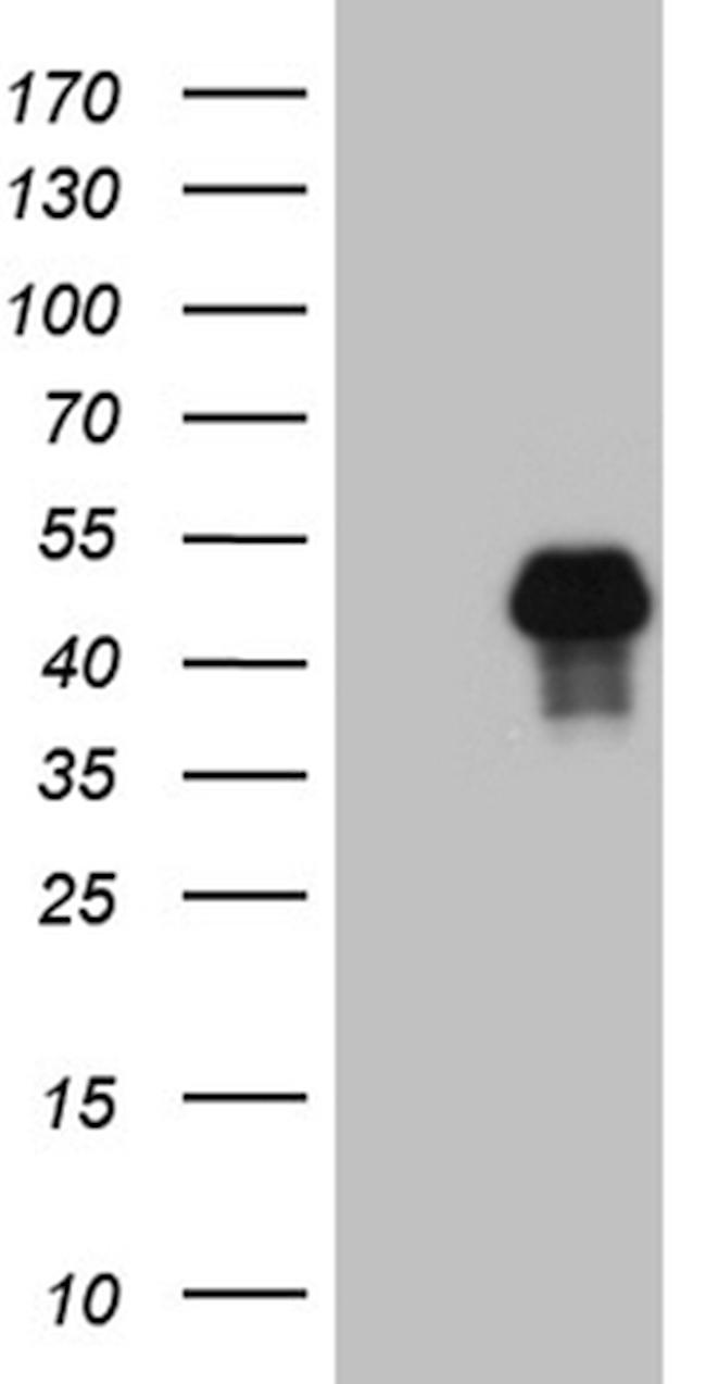 FOSL2 Antibody in Western Blot (WB)