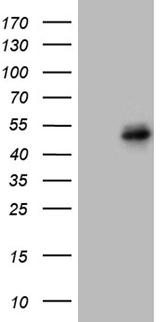 FOSL2 Antibody in Western Blot (WB)