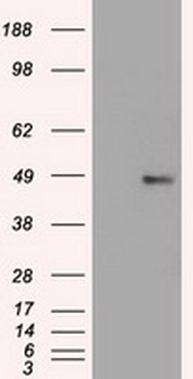 FOXA1 Antibody in Western Blot (WB)