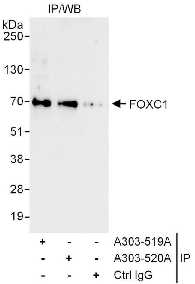 FOXC1 Antibody in Immunoprecipitation (IP)