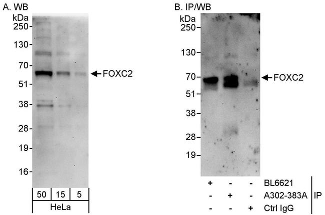 FOXC2 Antibody in Western Blot (WB)
