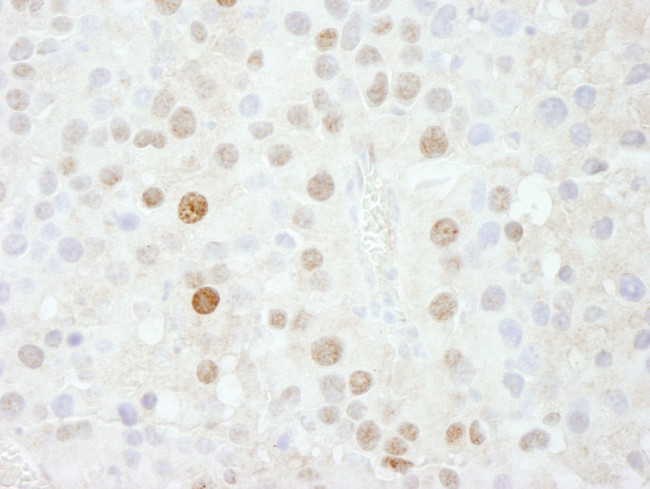 FOXK1 Antibody in Immunohistochemistry (IHC)