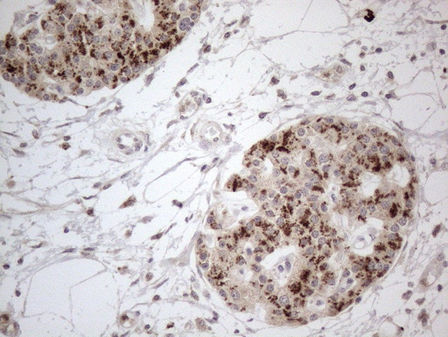 FOXO4 Antibody in Immunohistochemistry (Paraffin) (IHC (P))