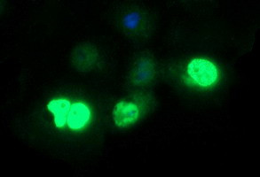 FOXP1 Antibody in Immunocytochemistry (ICC/IF)