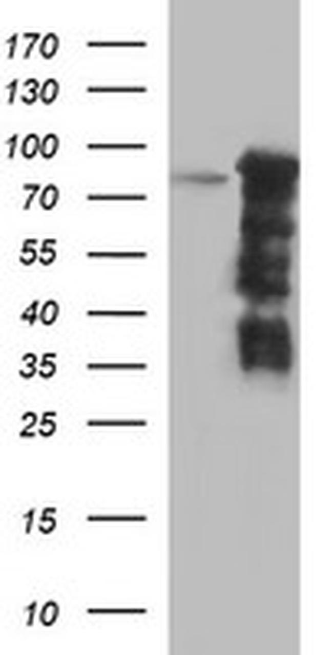 FOXP1 Antibody in Western Blot (WB)