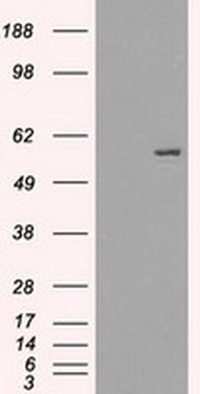 FRK Antibody in Western Blot (WB)