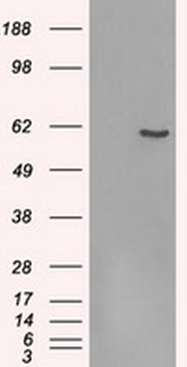 FRK Antibody in Western Blot (WB)