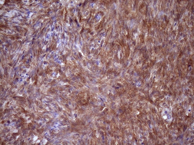 FSCN1 Antibody in Immunohistochemistry (Paraffin) (IHC (P))