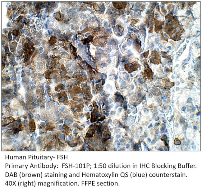 FSH Antibody in Immunohistochemistry (IHC)