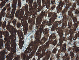 FTCD Antibody in Immunohistochemistry (Paraffin) (IHC (P))