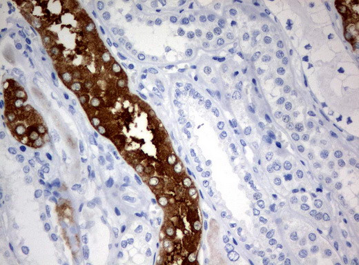 FTCD Antibody in Immunohistochemistry (Paraffin) (IHC (P))