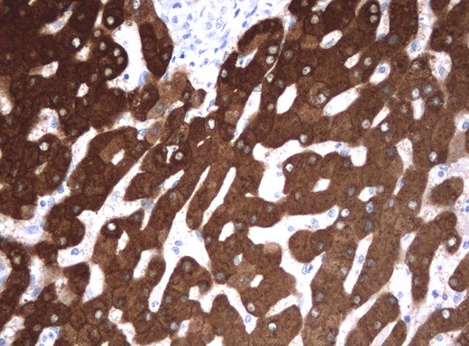 FTCD Antibody in Immunohistochemistry (Paraffin) (IHC (P))