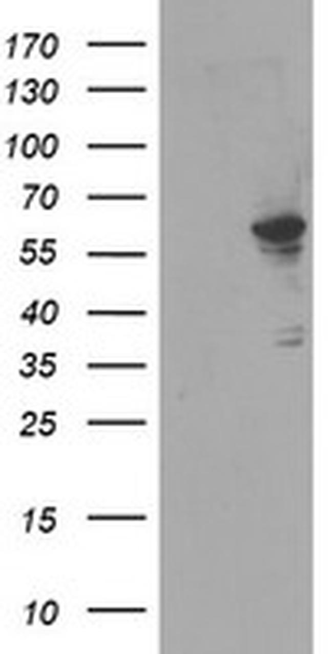 FTCD Antibody in Western Blot (WB)