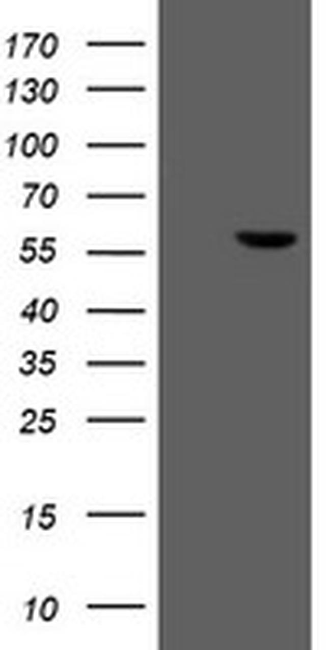 FTCD Antibody in Western Blot (WB)