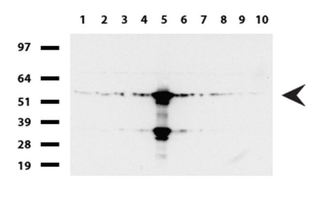 FTCD Antibody in Western Blot (WB)