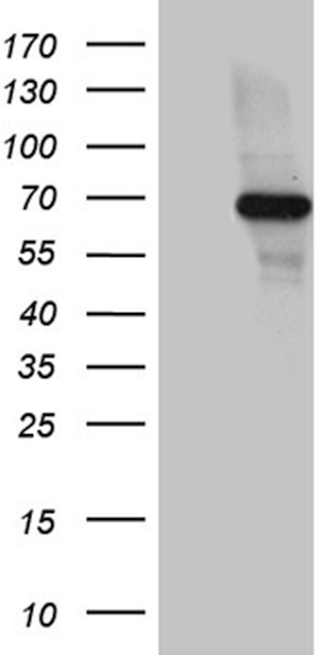 FUBP3 Antibody in Western Blot (WB)