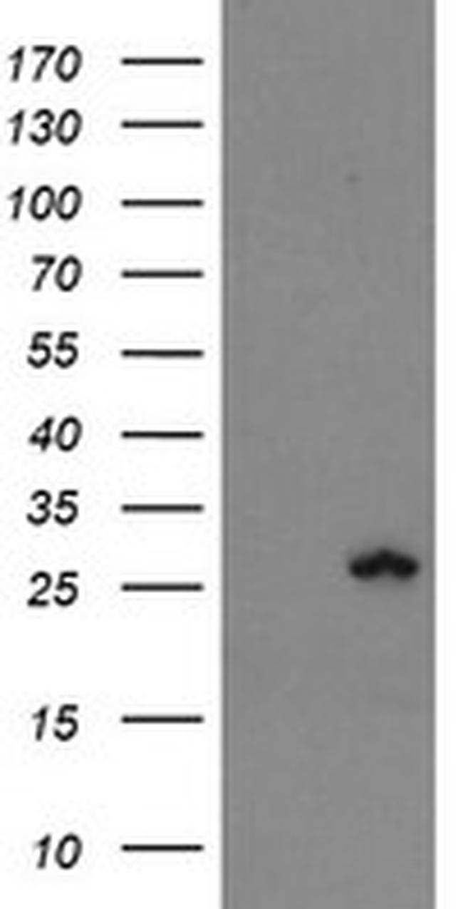 FXN Antibody in Western Blot (WB)