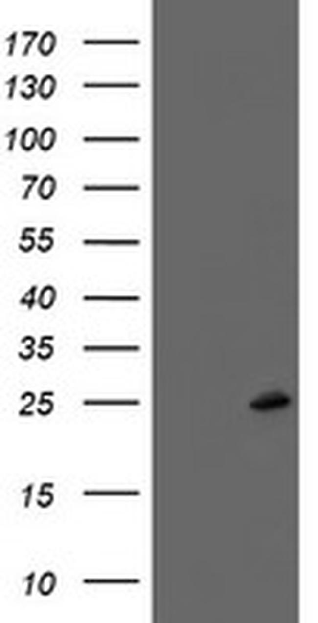 FXN Antibody in Western Blot (WB)