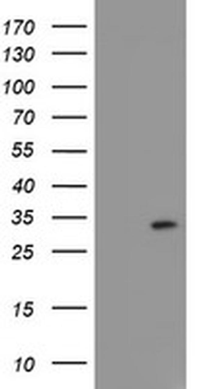 FXN Antibody in Western Blot (WB)