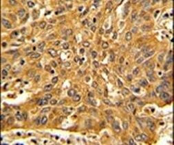 Fascin Antibody in Immunohistochemistry (IHC)