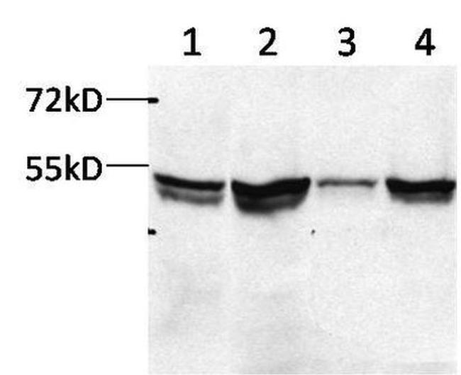 FDXR Antibody in Western Blot (WB)