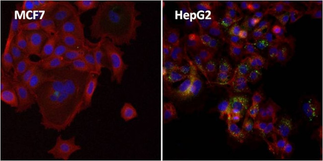 Ferritin Antibody in Immunocytochemistry (ICC/IF)