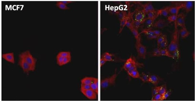 Ferritin Antibody in Immunocytochemistry (ICC/IF)