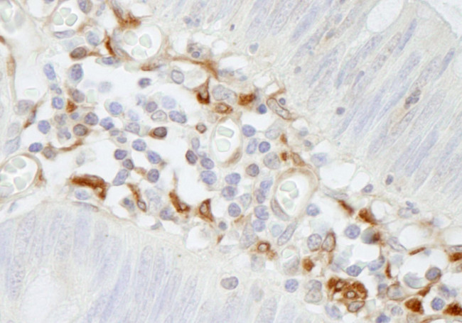 Filamin A Antibody in Immunohistochemistry (IHC)