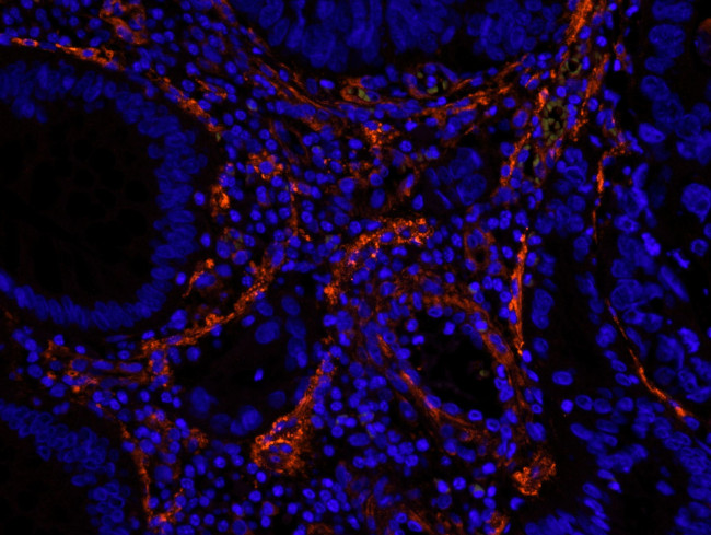 Filamin A Antibody in Immunohistochemistry (IHC)