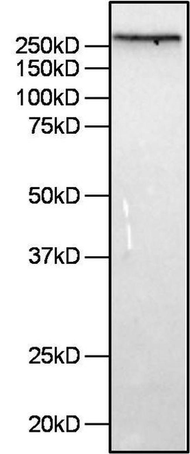 Filamin A Antibody in Western Blot (WB)