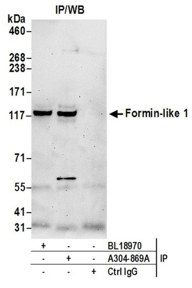 Formin-like 1/FMNL1 Antibody in Immunoprecipitation (IP)