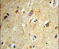 GABARAPL1 Antibody in Immunohistochemistry (IHC)