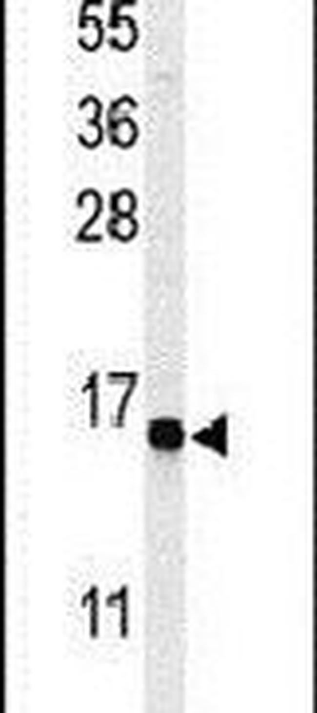 GABARAPL1 Antibody in Western Blot (WB)