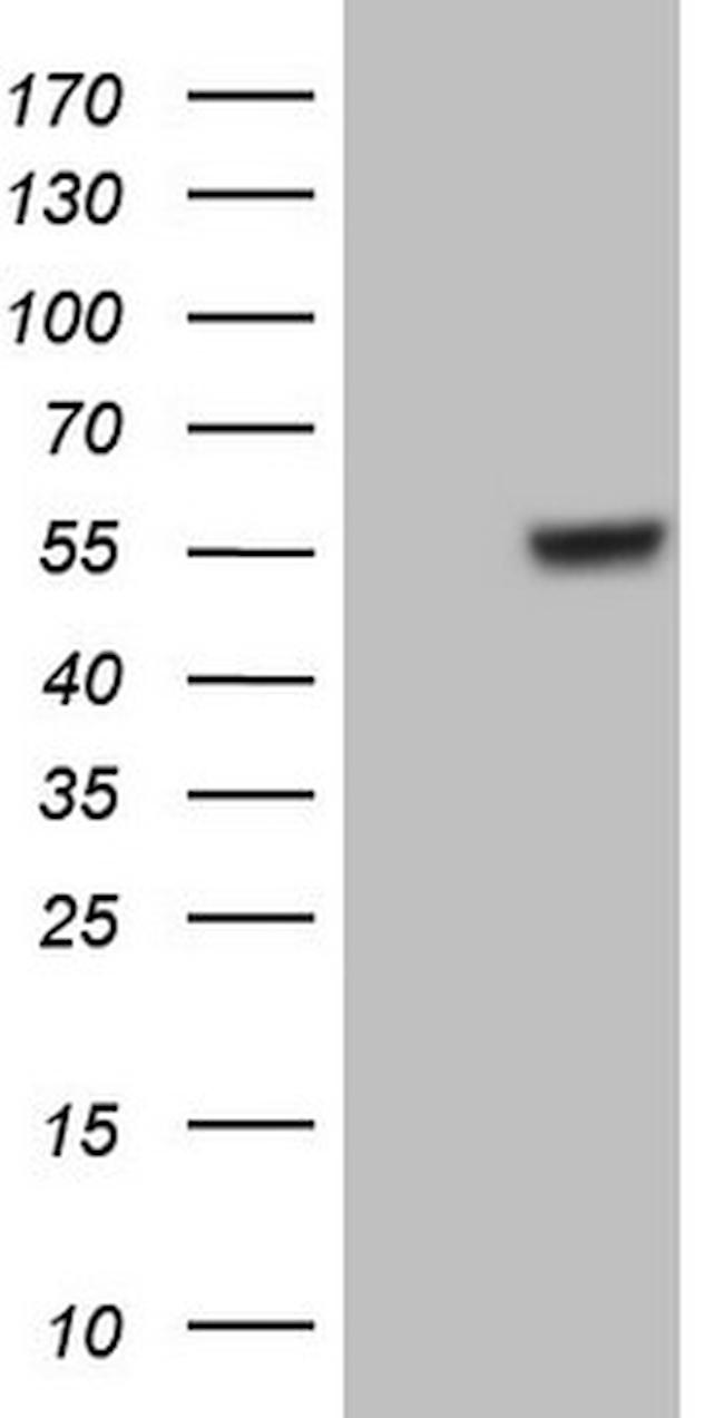 GABRA5 Antibody in Western Blot (WB)