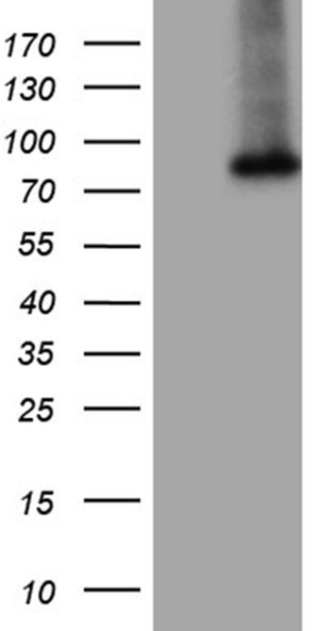 GALNT10 Antibody in Western Blot (WB)