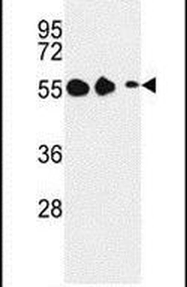 GALR1 Antibody in Western Blot (WB)