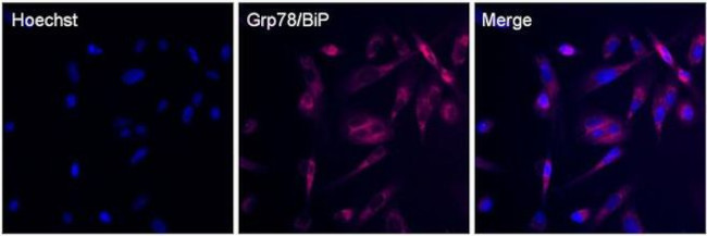 Rabbit IgG (Heavy chain) Secondary Antibody in Immunocytochemistry (ICC/IF)