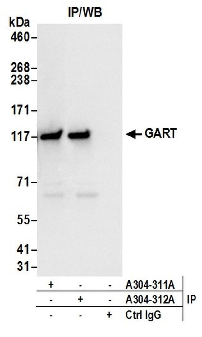 GART Antibody in Western Blot (WB)