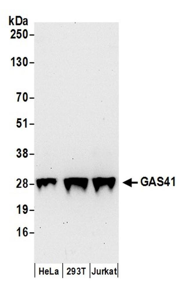 GAS41 Antibody in Western Blot (WB)