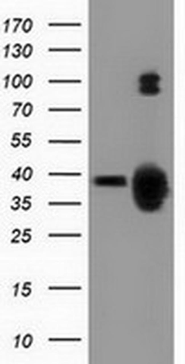 GAS7 Antibody in Western Blot (WB)