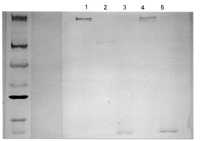 Complement C3a Antibody in Western Blot (WB)